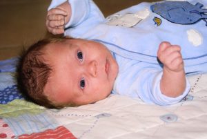 tortícolis congénita osteopatía