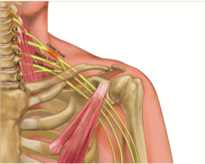 plexo braquial osteopatía