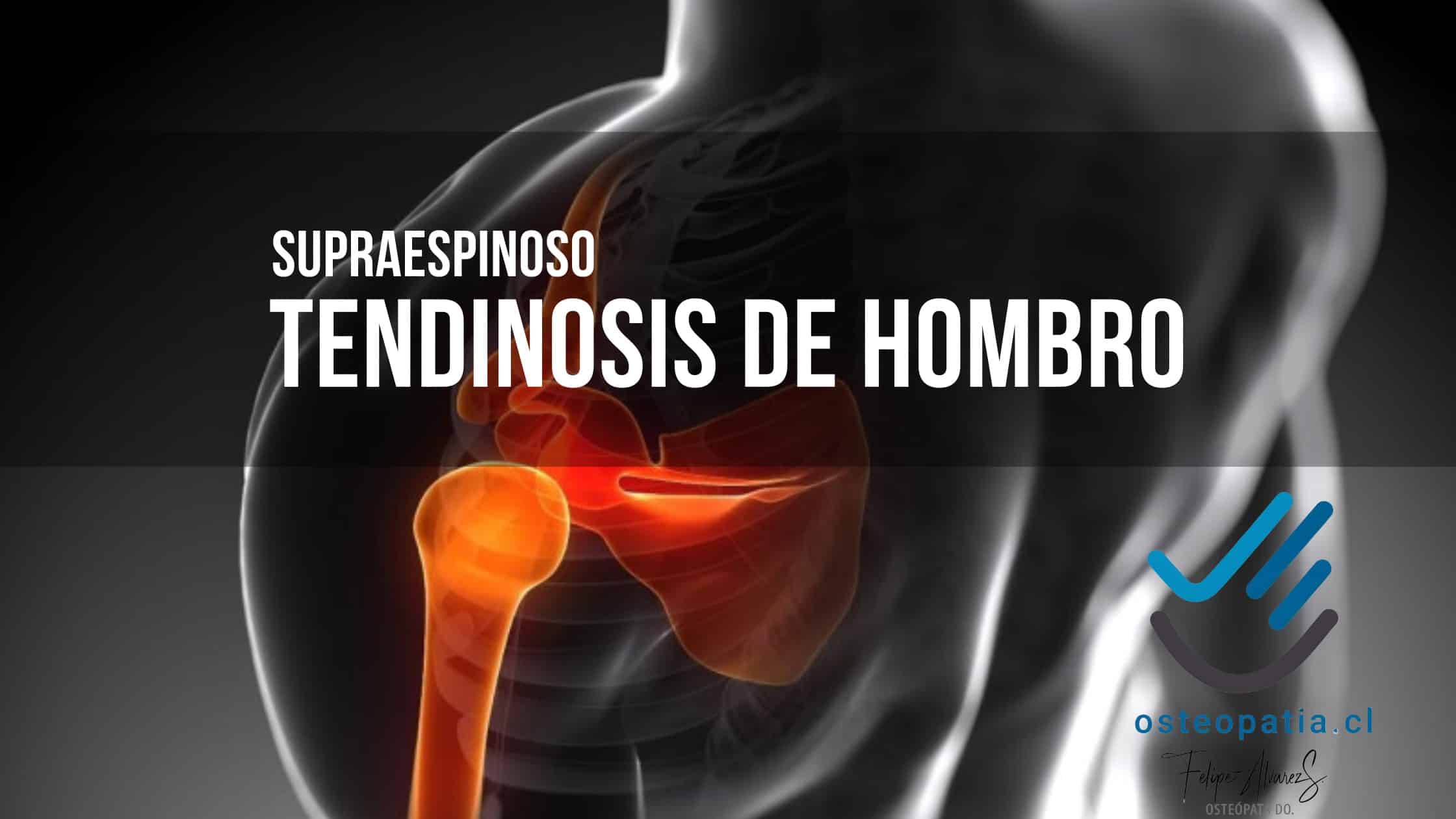 tendinosis del supraespinoso