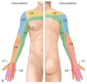 cervicobraquialgia_osteopatía